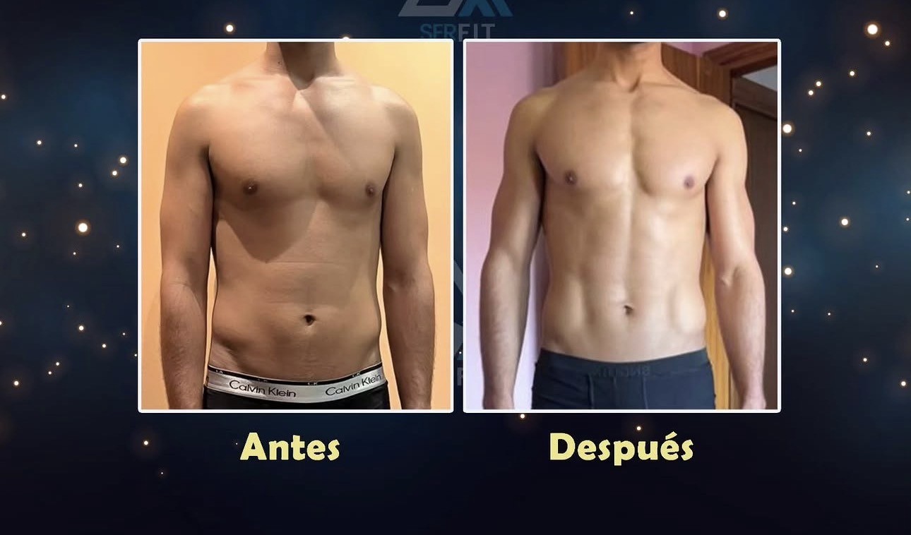 Antes y después frontal — Cliente 7