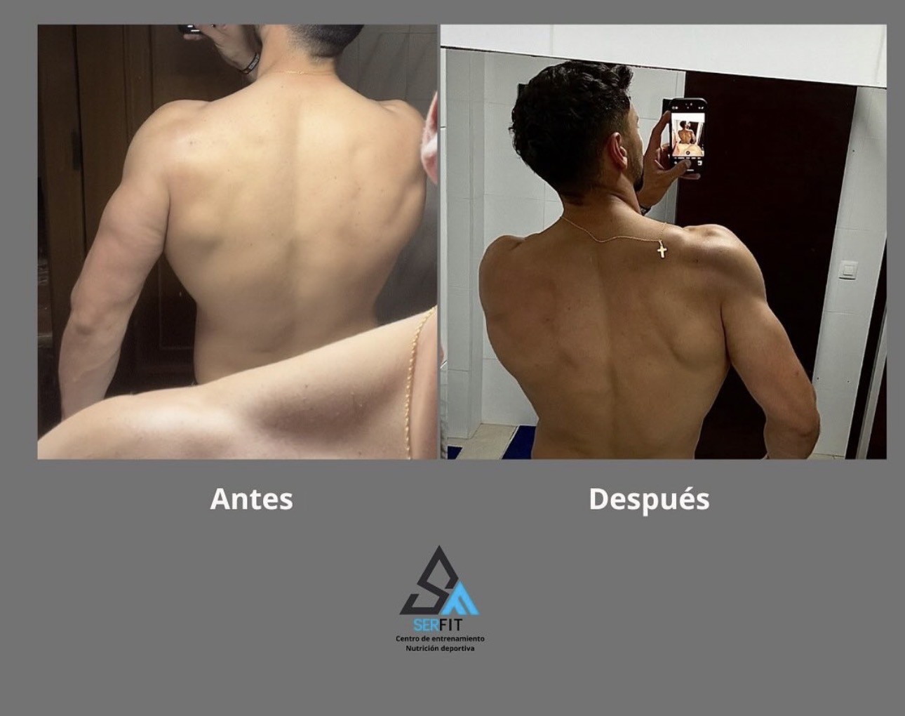 Antes y después de espalda — Cliente 3