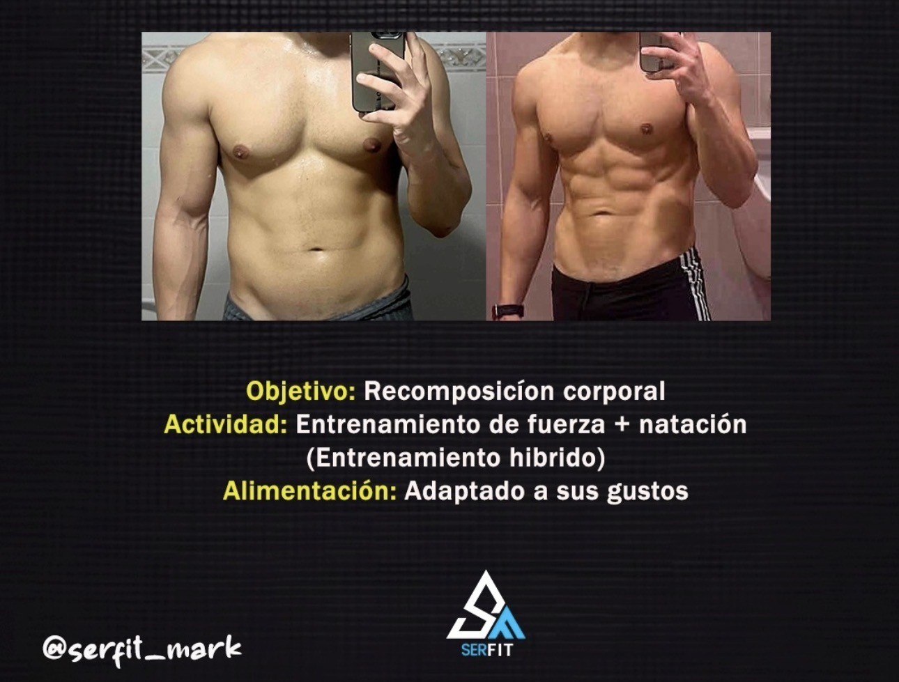 Antes y después frontal — Cliente 4