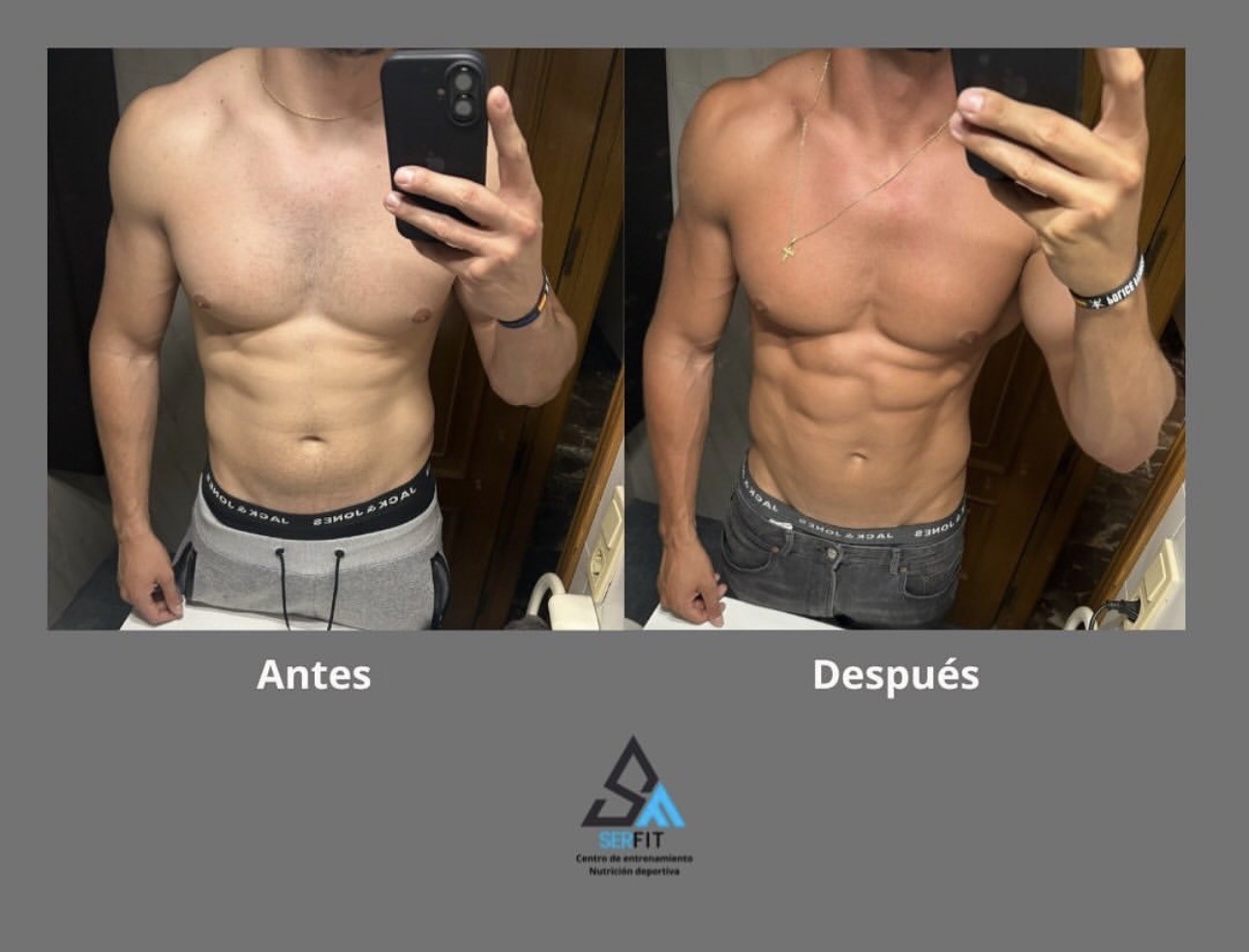 Antes y después frontal — Cliente 3