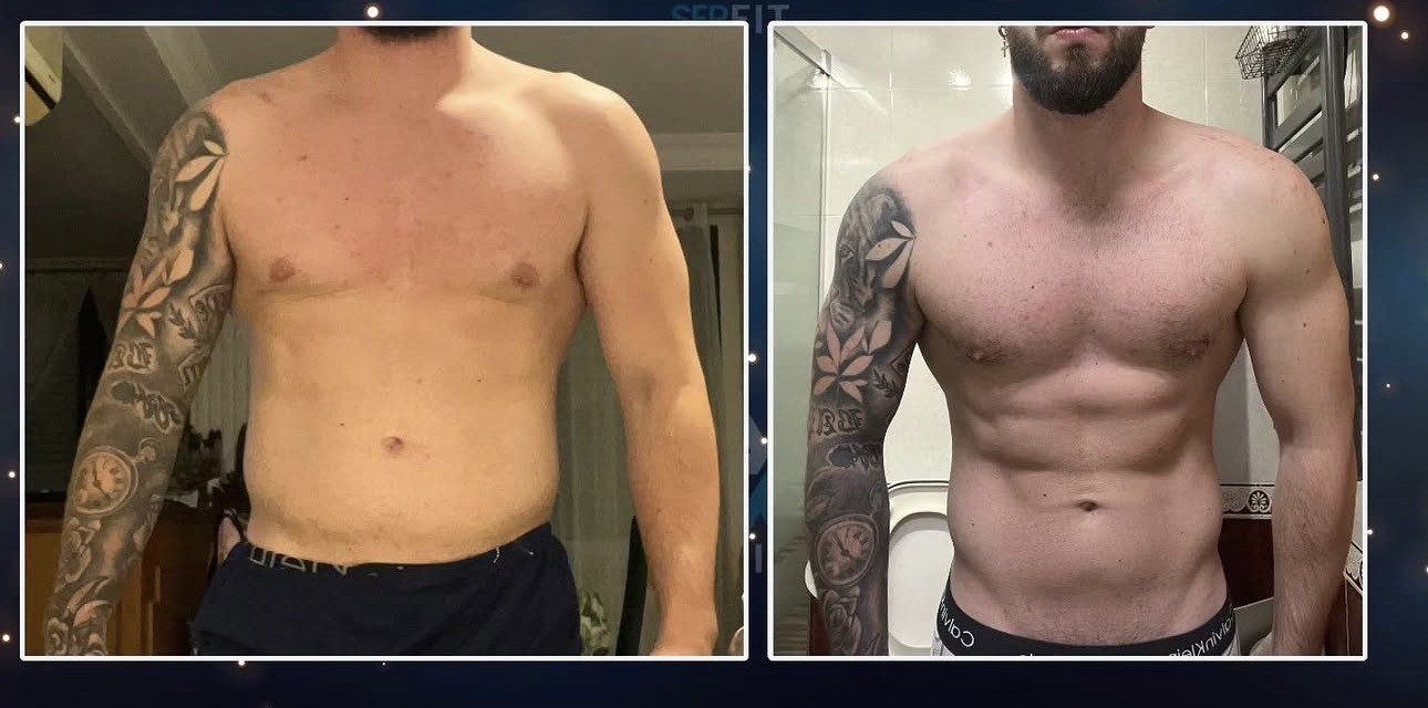 Antes y después frontal — Cliente 8