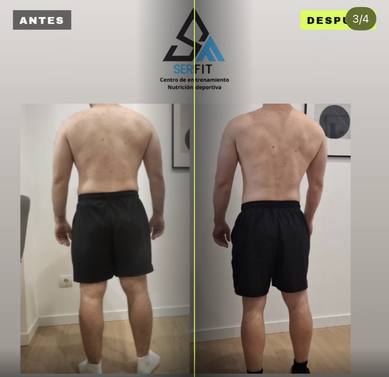 Antes y después de espalda — Cliente 1